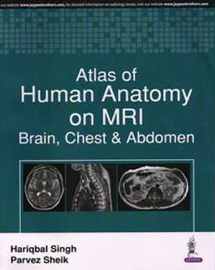 Atlas Of Human Anatomy On MRI Brain, Chest & Abdomen