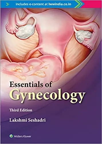 Essentials Of Gynaecology